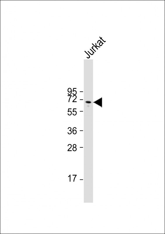 WB - Glypican 3 (GPC3) Antibody (N-term) AP6337a